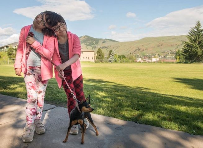 When Two Brains Become One: The Shocking Truth About 10 Pairs of Connected Twins.