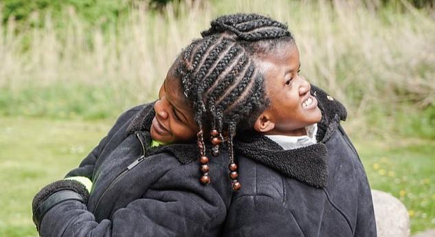 When Two Brains Become One: The Shocking Truth About 10 Pairs of Connected Twins.